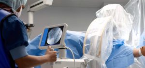 دستگاه پرتابل فلوروسکوپی BV Pulsera - Mobile C-arm