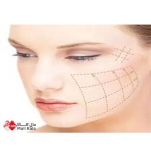 لیفت پیشانی