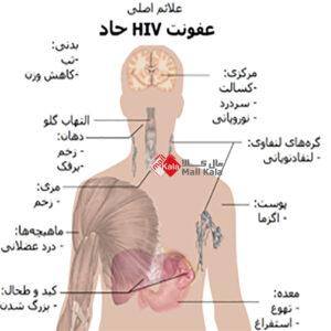 ویروس ایدزHIV