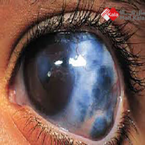 دلیل آب سیاه چشم