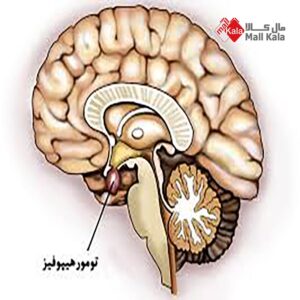 غده هیپوفیز