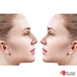 جراحی زیبایی صورت