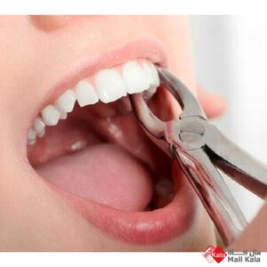 ترک خوردن دندان