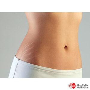 علت ترک خوردن پوست