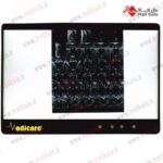 نگاتسکوپ LED