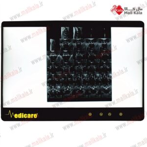 نگاتسکوپ LED